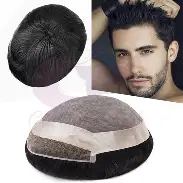What Are Top Hair Solution Services for Baldness Thinning Hair?