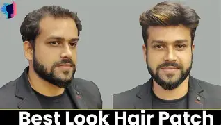 What is Advanced Non-Surgical Hair Replacement?