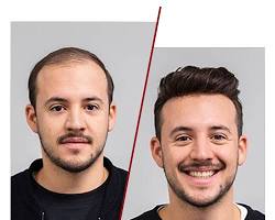 Affordable Wig Services Near Me