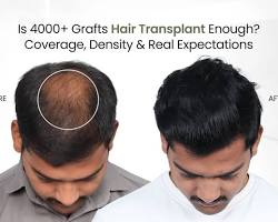  Hair Solution Services